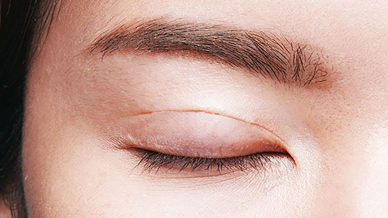  Phun mí mắt có ảnh hưởng đến thị lực và sức khỏe không?