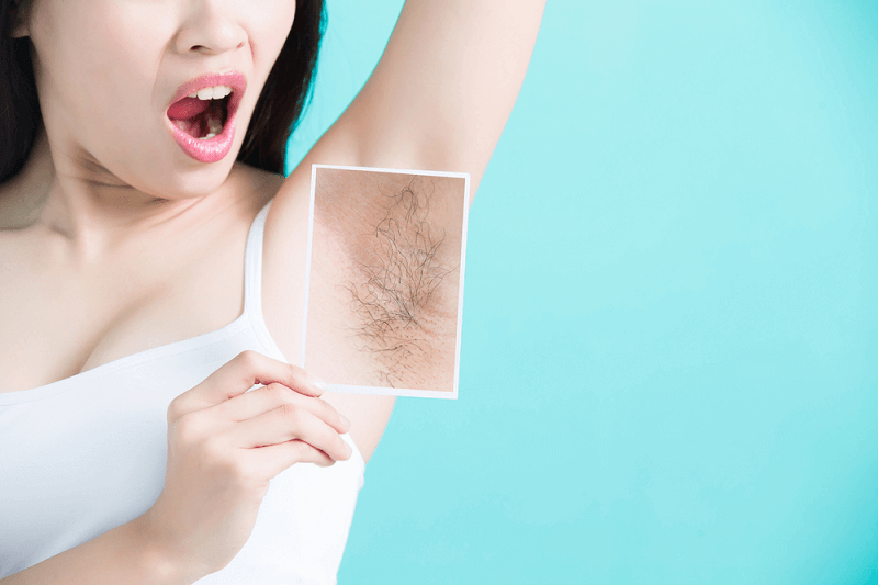 wax lông nách có thể khiến các sợi lông mọc nhiều hơn sau một thời gian