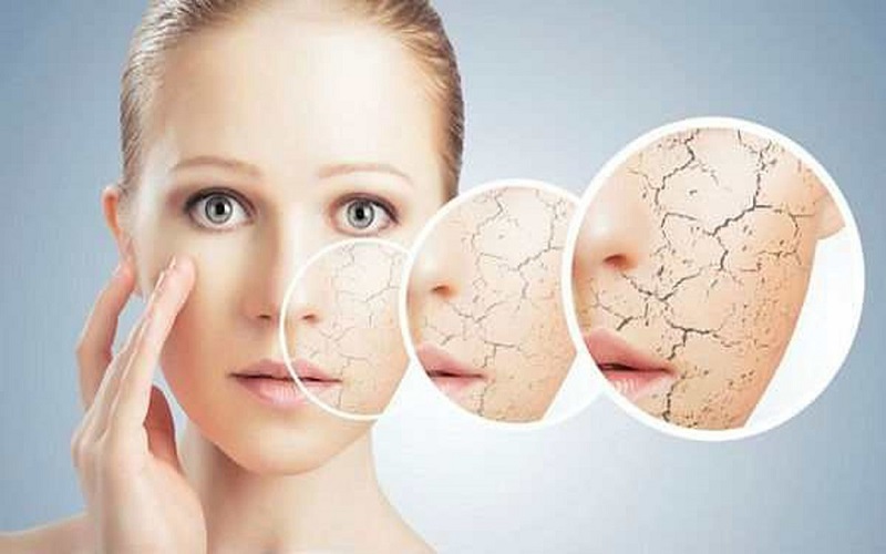 Da mặt khô sần sùi phải làm sao? 7 Cách chăm sóc da hiệu quả