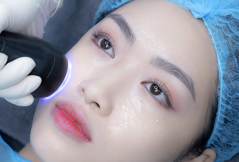 Phương pháp trẻ hóa da mặt bằng công nghệ Laser