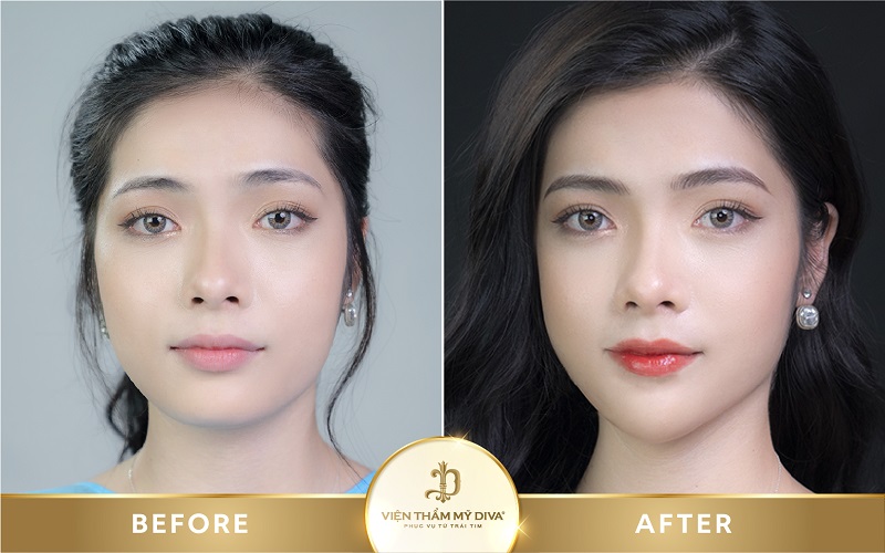 Trước và sau khi phun môi và mày tại Viện thẩm mỹ DIVA - Lâm Hà