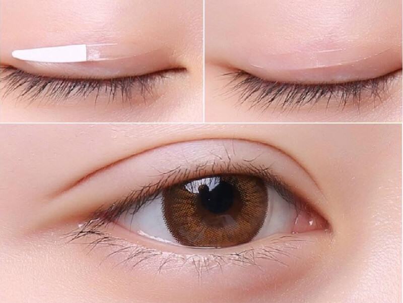 5 cách nhấn mí mắt không phẫu thuật tại nhà hiệu quả nhất