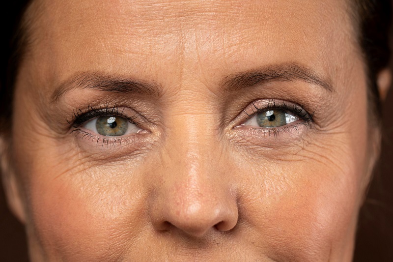 Nguyên nhân khiến vùng mắt lão hóa nhanh?
