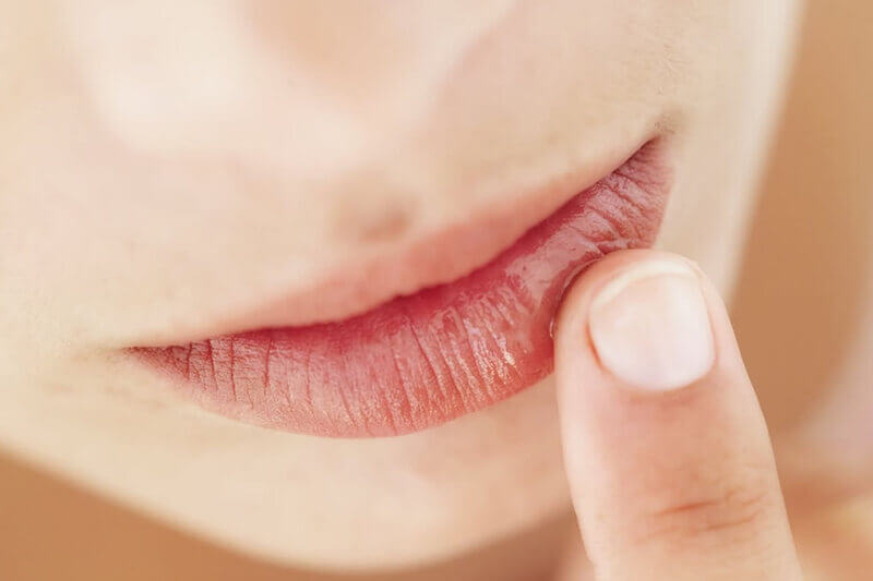 Những lưu ý khi dùng thuốc Acyclovir bôi môi để đảm bảo an toàn