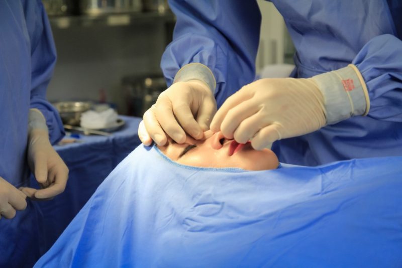 Phẫu thuật chỉnh sửa các biến chứng sau chích chất làm đầy vùng mũi