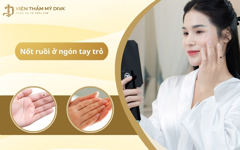 Giải Mã Bí Ẩn Nốt Ruồi Ở Ngón Tay Trỏ: Vận Mệnh, Sự Nghiệp & Tình Duyên