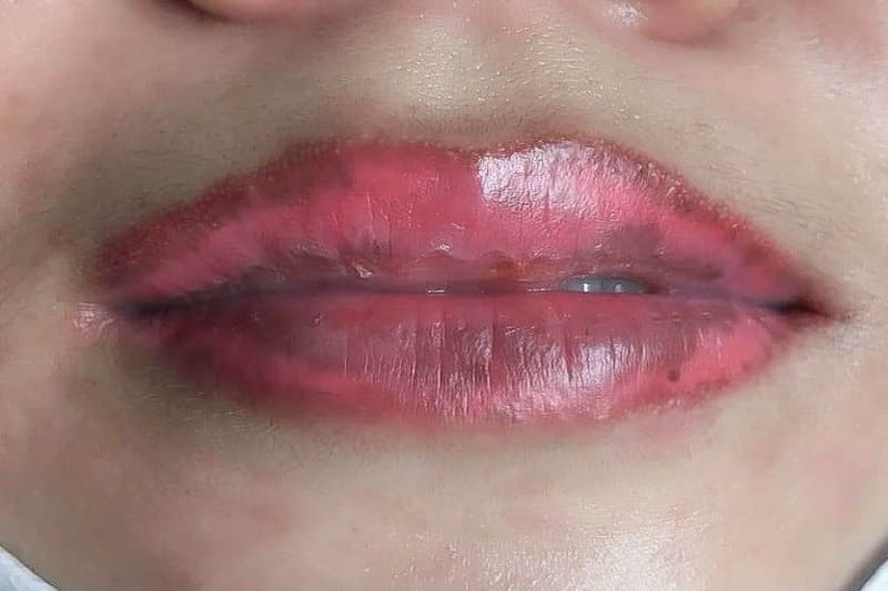 Phun môi 1 tháng chưa lên màu vì sao Làm thế nào khắc phục