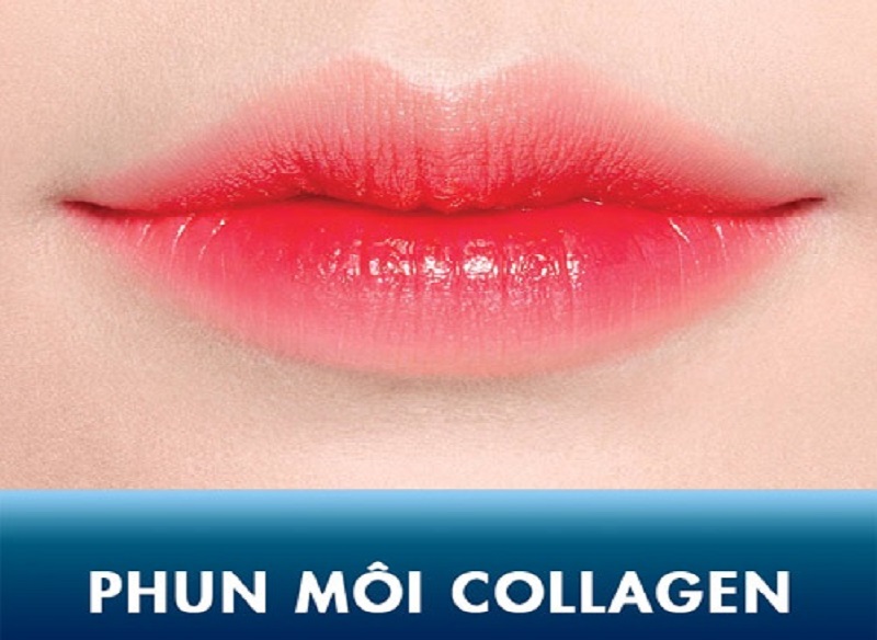 Phun môi collagen đẹp cho phái nữ