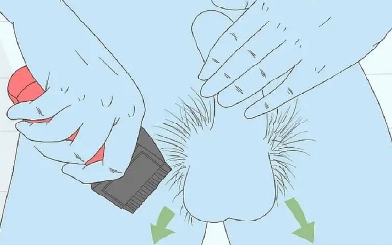 Bạn thực hiện đẩy tông đơ lên trên phần lông vùng kín xung quanh bộ phận sinh dục