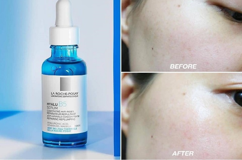 Serum B5 La Roche Posay dùng có tốt không?