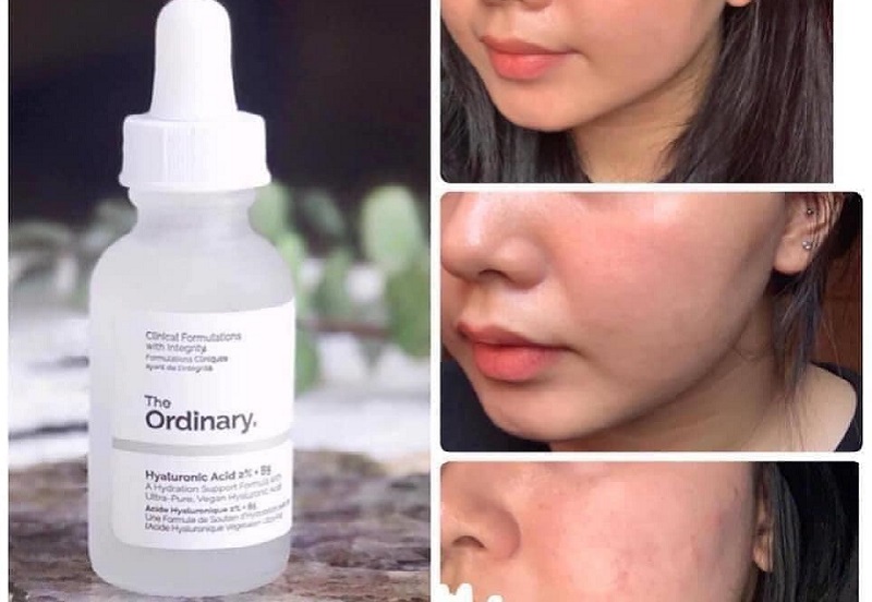 Công dụng của serum B5 The Ordinary 