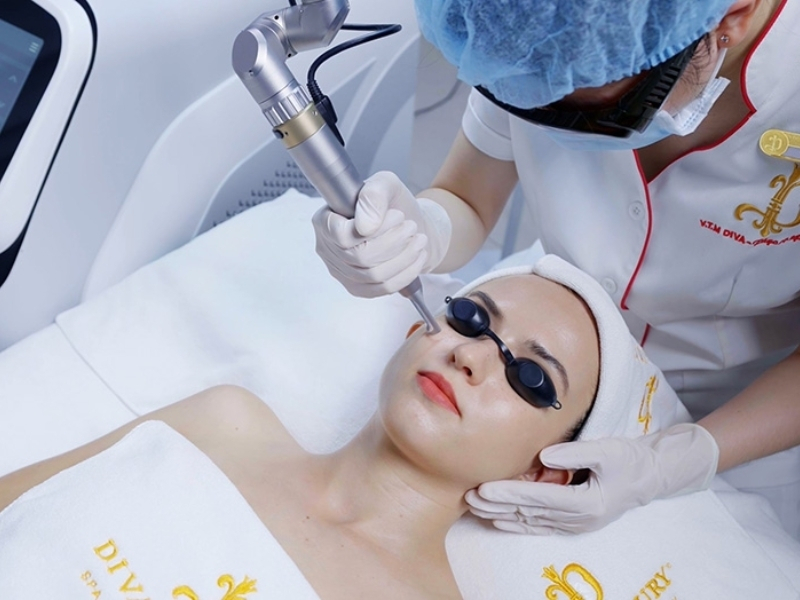 Điều trị mụn chuyên sâu bằng Laser tại Viện thẩm mỹ DIVA