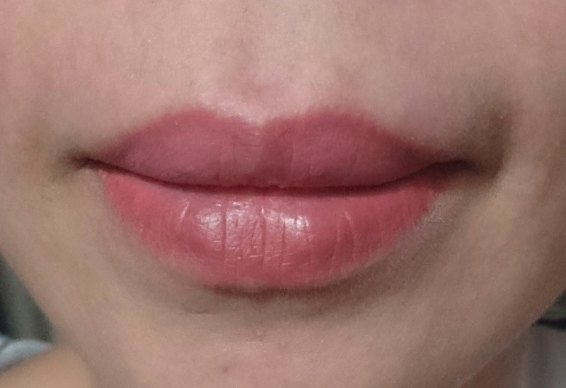 Xăm môi 1 tháng vẫn thâm phải làm sao? Mẹo khắc phục?