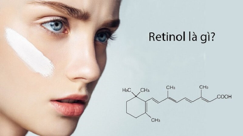Kem trị nám retinol là gì?