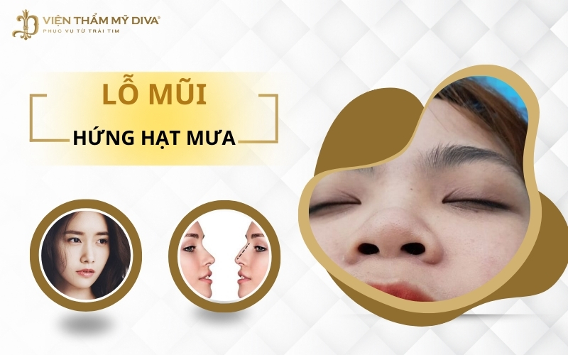 Lỗ mũi hứng hạt mưa là như thế nào? Tướng số Tốt hay Xấu