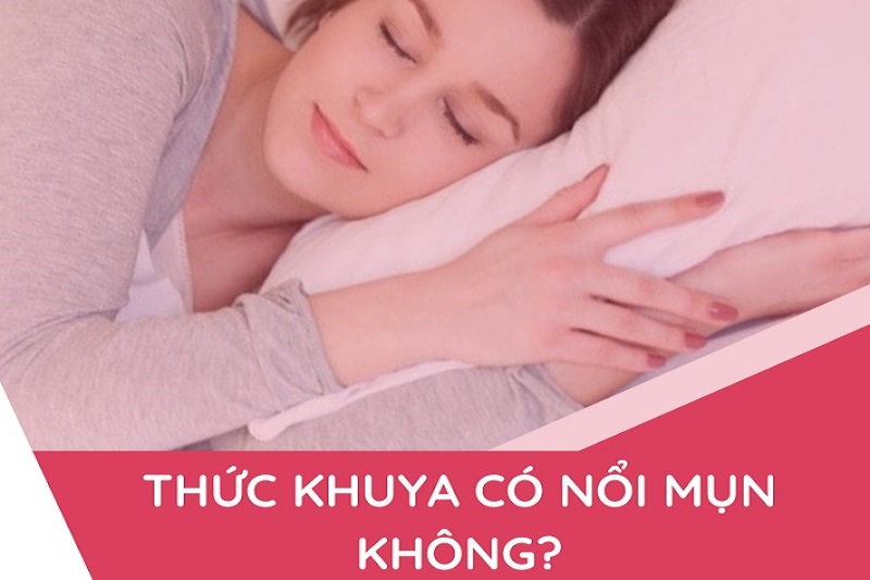 Thức khuya có nổi mụn không? Mẹo thức khuya mà da vẫn đẹp