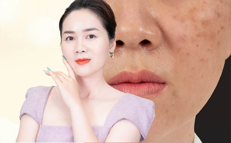 Collagen tươi