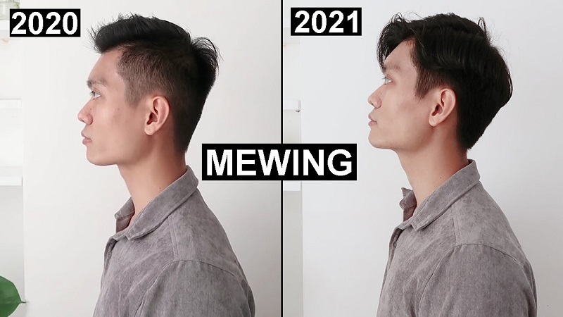 Mewing là tên gọi của thuật ngữ "Proper Tongue Posture" dùng để chỉ cách đặt lưỡi đúng vị trí trên vòm miệng