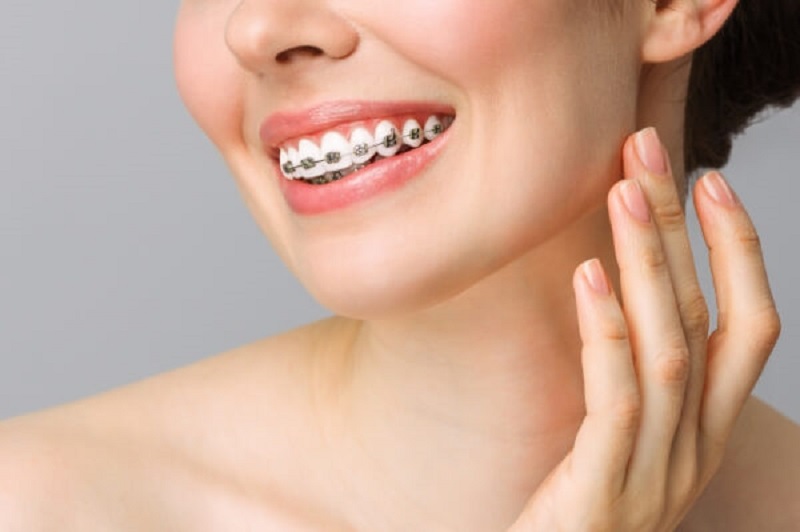 Niềng răng bị lệch mặt | Nguyên nhân và cách khắc phục