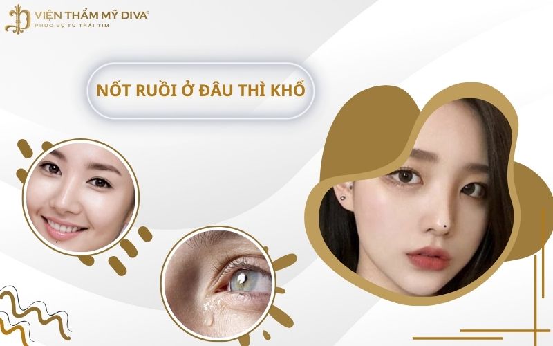 Nốt Ruồi Ở Đâu Thì Khổ? 10 Vị Trí Nốt Ruồi Bạn Cần Biết