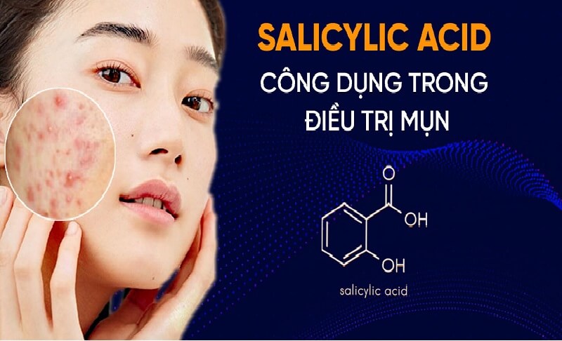 Axit Salicylic có công dụng gì đối với làn da?