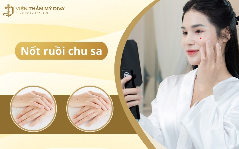 Nốt ruồi chu sa: Điềm báo may mắn, tài lộc và hạnh phúc?