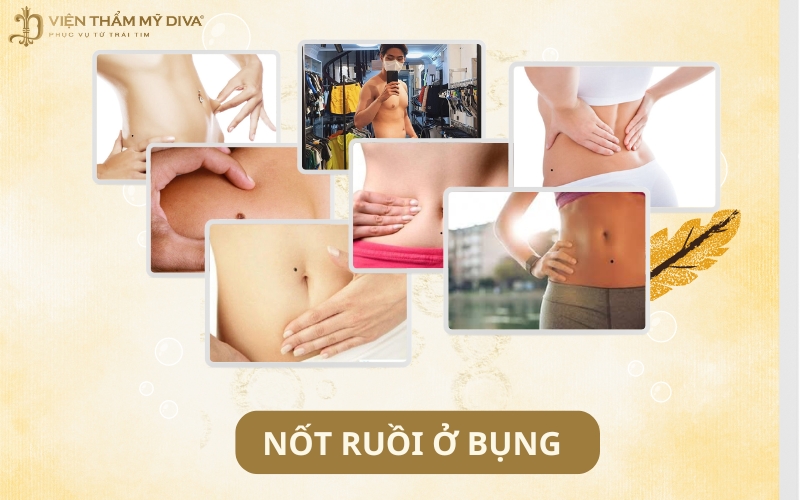 Nốt Ruồi Ở Bụng: Giải Mã Ý Nghĩa Theo Vị Trí Và Hình Dạng