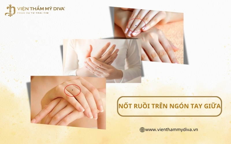 Nốt Ruồi Trên Ngón Tay Giữa Có Ý Nghĩa Gì? Bật Mí Điều Thú Vị Ít Người Biết