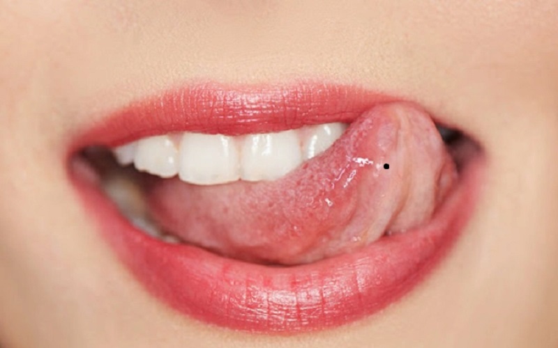 Nốt ruồi ở lưỡi: bí ẩn của những người có tài ăn nói