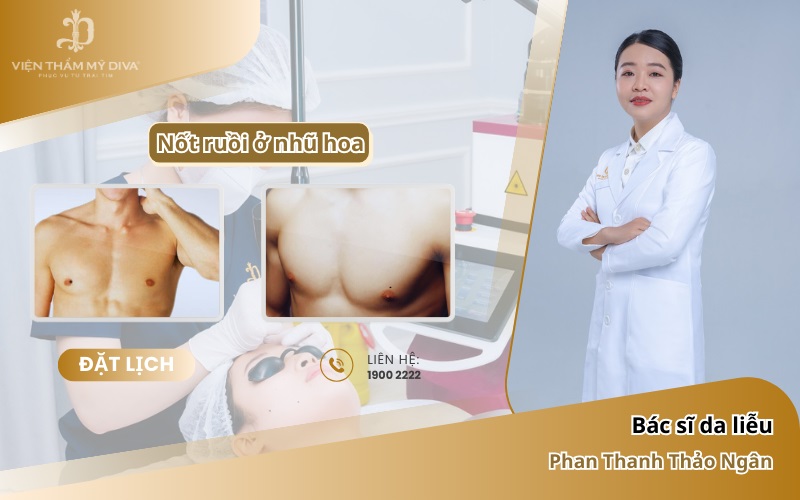 Nốt Ruồi Ở Nhũ Hoa: Ý Nghĩa Tướng Số Về Tình Duyên, Hôn Nhân Và Con Cái