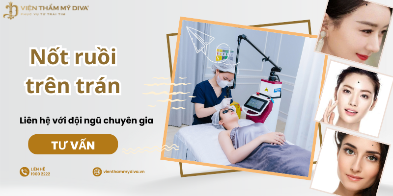 Nốt Ruồi Trên Trán: Ý Nghĩa, Phong Thủy Và Những Điều Cần Biết