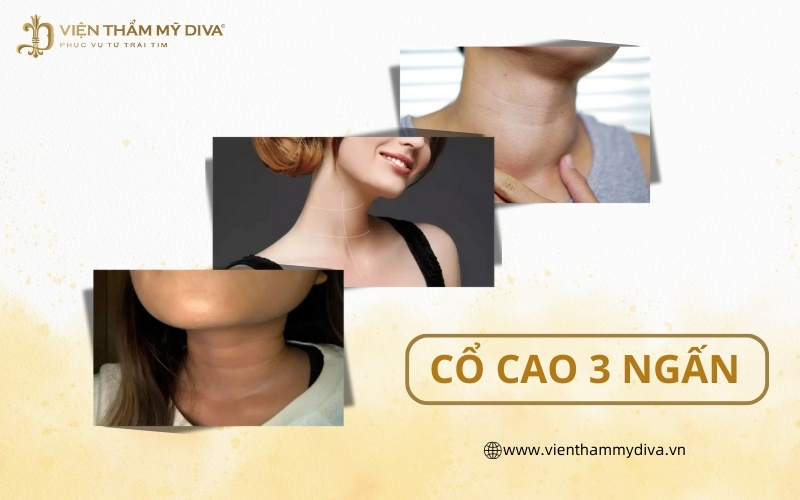 Cổ cao 3 ngấn ở Nam, Nữ có ý nghĩa gì? Tốt hay Xấu?