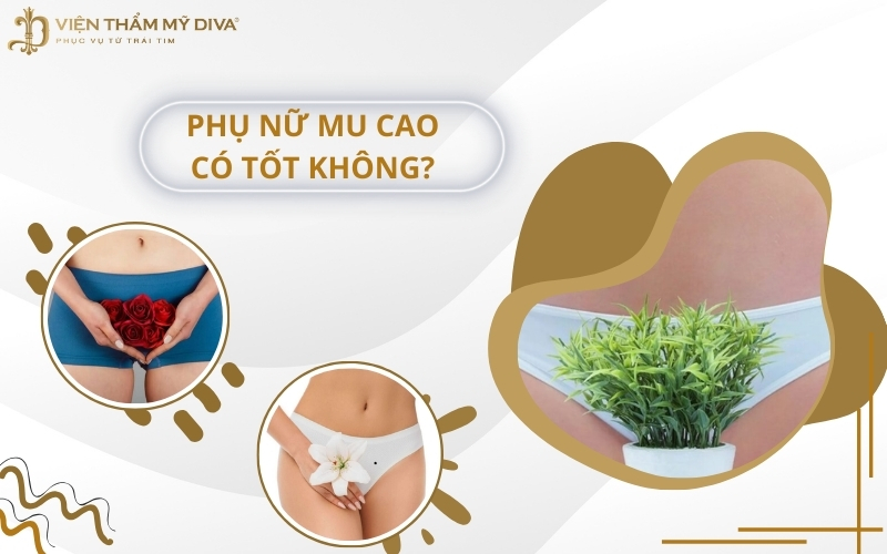 Phụ nữ mu cao có tốt không? Xem tướng số Tốt hay Xấu?