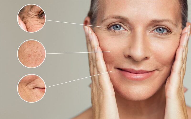 Tại sao phụ nữ tuổi 40 lại cần bổ sung collagen?