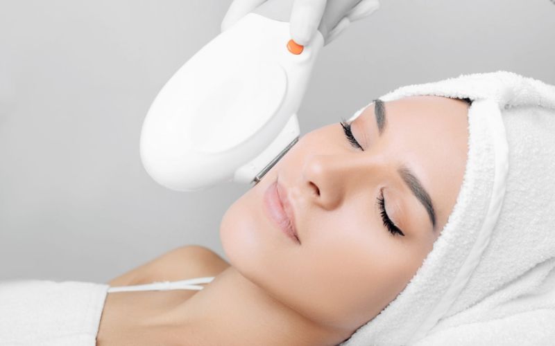 Điều trị đốm nâu bằng ánh sáng IPL