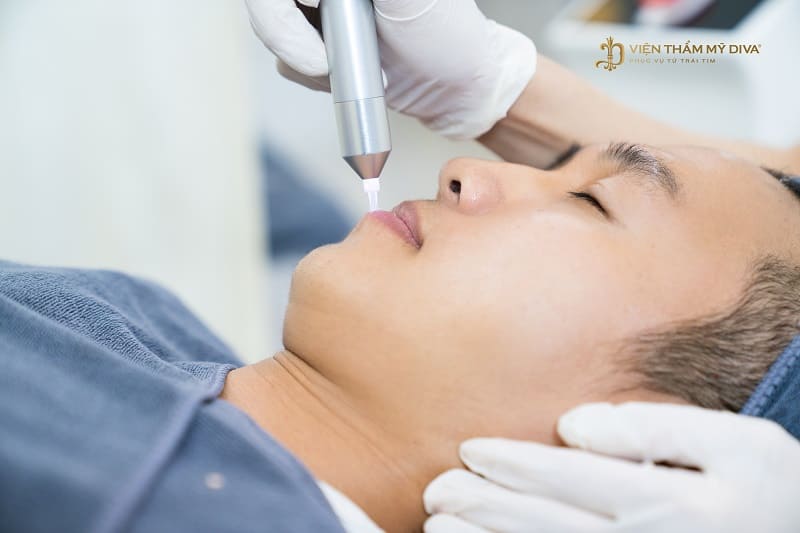 Công Nghệ Plasma Lạnh - Bước Đột Phá Trẻ Hóa Da Tại Viện Thẩm Mỹ Diva 15