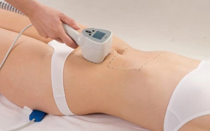 Top 5 Địa Chỉ Điêu Khắc Body Bình Dương An Toàn, Hiệu Quả 2