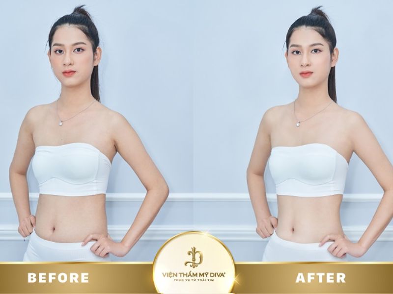 Top 5 Địa Chỉ Điêu Khắc Body Bình Dương An Toàn, Hiệu Quả 7