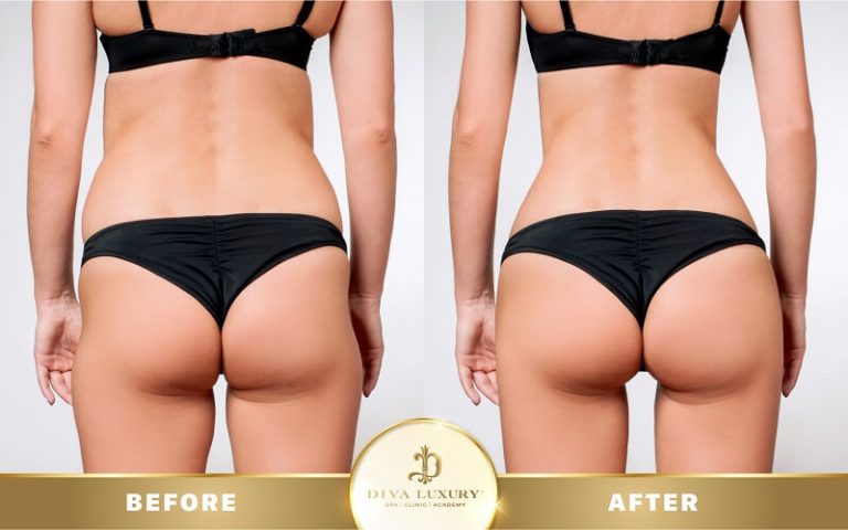 Top 5 Địa Chỉ Điêu Khắc Body Tại Long An Bạn Không Nên Bỏ Qua 7