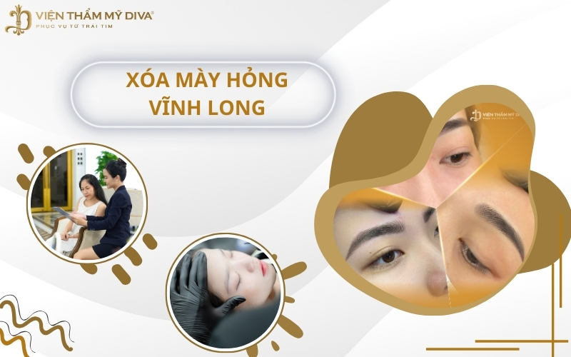 Top 5 Địa Chỉ Xóa Chân Mày Hỏng Uy Tín Ở Vĩnh Long