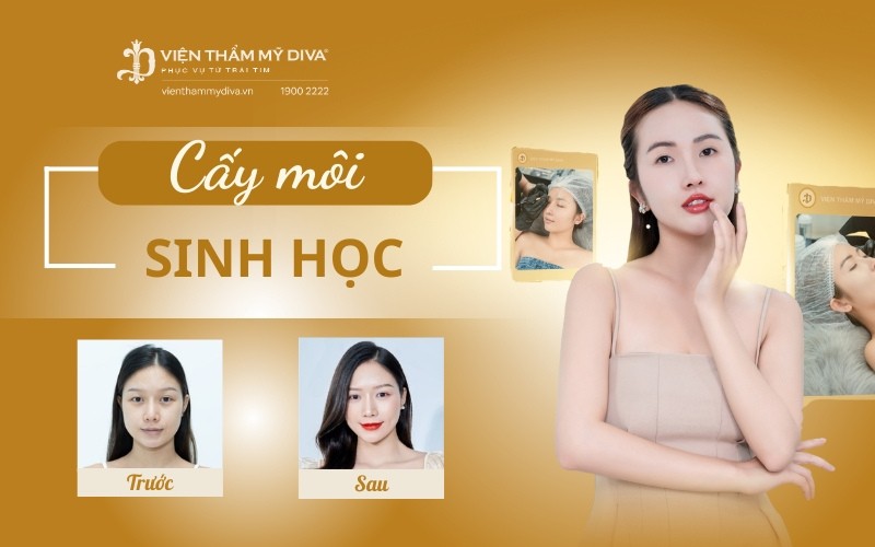 Gợi Ý Top 10 Địa Chỉ Cấy Môi Sinh Học Bạc Liêu Uy Tín, Màu Đẹp 1