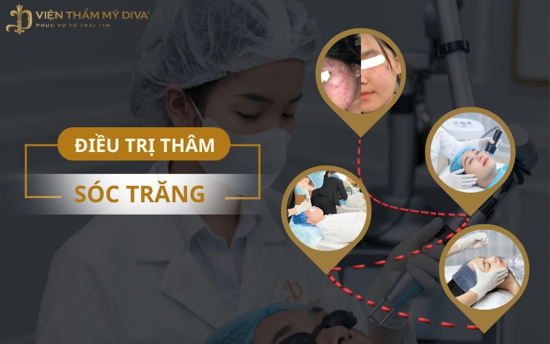 Top 5 Địa Chỉ Điều Trị Thâm Ở Sóc Trăng An Toàn, Sử Dụng Công Nghệ Cao