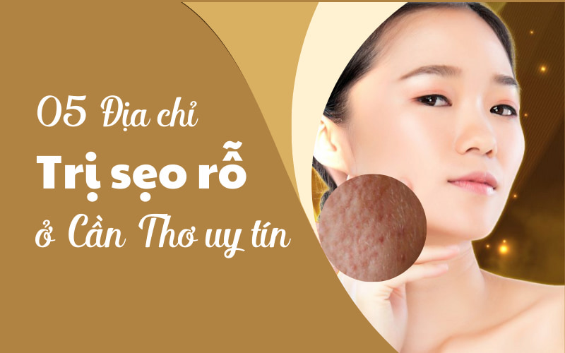 Top 05 Địa Chỉ Điều Trị Sẹo Rỗ Ở Sóc Trăng An Toàn, Uy Tín Nhất