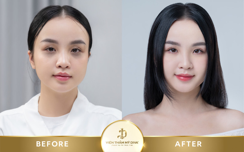 trước sau làm đẹp