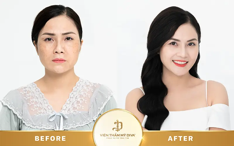 trước sau làm đẹp