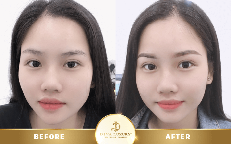 chuong-trinh-noel-vien-tham-my-diva chuong-trinh-noel-vien-tham-my-diva