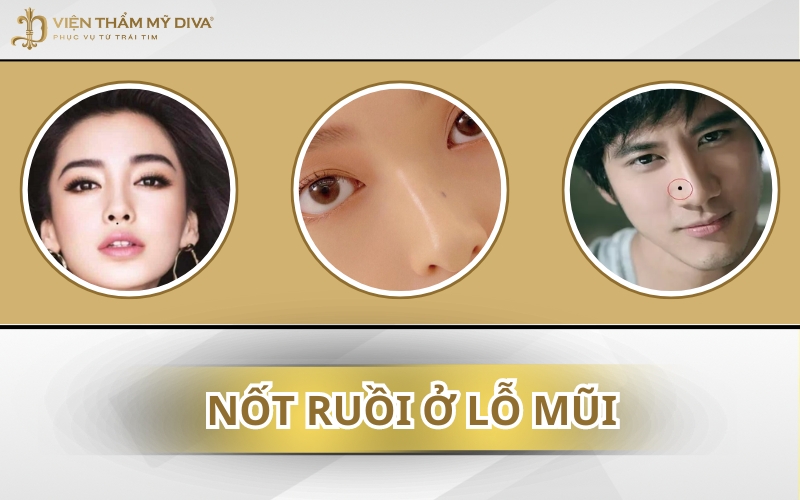 Nốt Ruồi Ở Lỗ Mũi: Điềm Báo Tình Duyên Lận Đận, Tài Chính Khó Khăn?