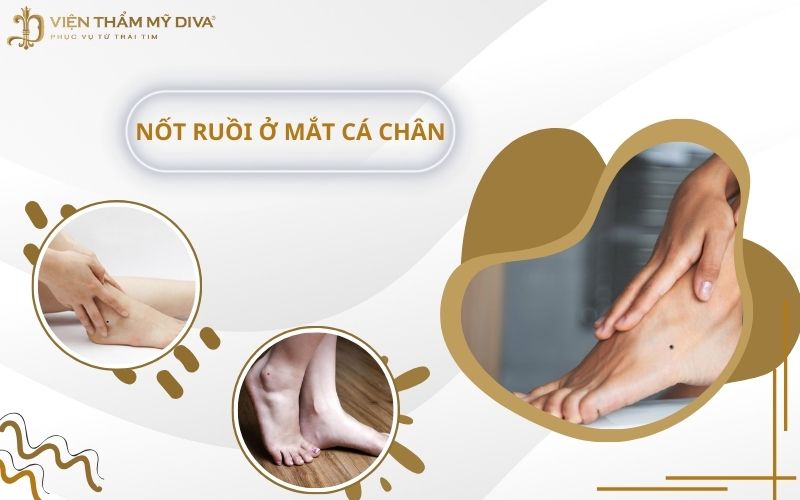 Nốt Ruồi Ở Mắt Cá Chân: Bí Mật Về Tướng Số Và Sức Khỏe