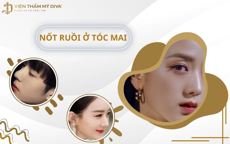 Giải mã bí ẩn ý nghĩa nốt ruồi ở tóc mai theo vị trí và giới tính