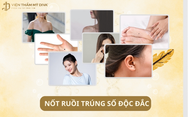8 Nốt Ruồi Trúng Số Độc Đắc Trên Cơ Thể Nam Và Nữ